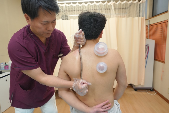 施術（検査・評価・手技・物理療法・鍼灸）